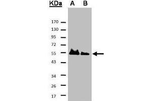 Western blot analysis of A: His-Hice1 (2x); B: His-Hice1 (1x) using a 7. (NYS48/HAUS8 抗体)