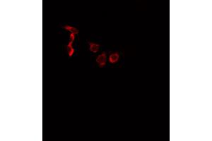 ABIN6266452 staining A549 cells by IF/ICC. (EPHA2/3/4 抗体  (pTyr588, pTyr596))
