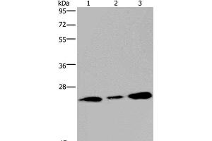 Western Blot analysis of Human fetal brain tissue and 293T cell using RAB3c Polyclonal Antibody at dilution of 1:400 (Rab3c 抗体)