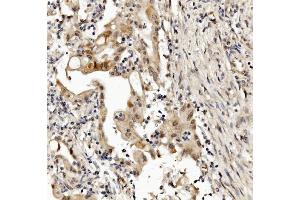 IHC analysis of MED4 using anti-MED4 antibody (ABIN7600817).