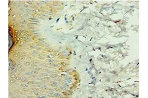 Immunohistochemistry of paraffin-embedded human skin tissue using ABIN7156908 at dilution of 1:100 (FIL1d 抗体  (AA 1-155))