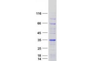 ODF3 Protein (Myc-DYKDDDDK Tag)