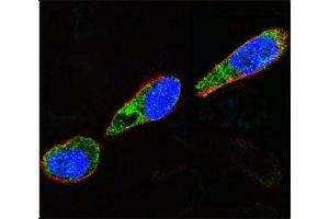 Confocal immunofluorescent analysis of Src antibody with A375 cells followed by Alexa Fluor 488-conjugated goat anti-rabbit lgG (green). (Src 抗体  (AA 397-424))