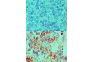 Image no. 1 for anti-Importin 7 (IPO7) (AA 1-50) antibody (ABIN960236) (IPO7 抗体  (AA 1-50))