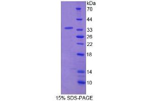 SDS-PAGE analysis of Human NASP Protein. (NASP 蛋白)