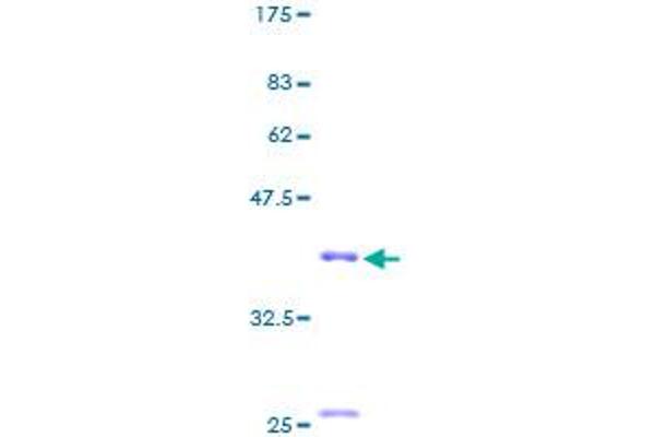 MIA Protein (AA 1-131) (GST tag)