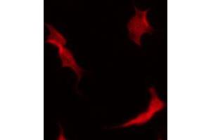 ABIN6267536 staining MDA-MB-435 by IF/ICC. (MAP2K3 抗体  (pSer189))