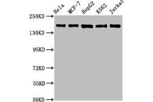 Western Blot Positive WB detected in: Hela whole cell lysate, MCF-7 whole cell lysate, HepG2 whole cell lysate, K562 whole cell lysate, Jurkat whole cell lysate All lanes: HDAC6 antibody at 1. (Recombinant HDAC6 抗体)