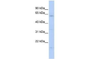 Western Blotting (WB) image for anti-F-Box and WD Repeat Domain Containing 11 (FBXW11) antibody (ABIN2458711) (FBXW11 抗体)