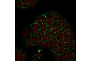Confocal Immunofluorescence of MCF-7 cells Ep-CAM Monoclonal Antibody (EGP40/1798) labeled with CF488 (Green); Reddot is used to label the nuclei.