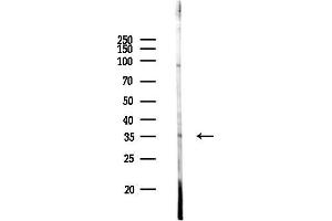 anti-G Protein Pathway Suppressor 2 (GPS2) (N-Term) antibody