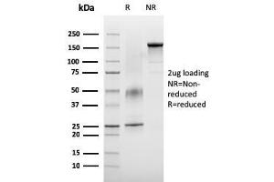 SDS-PAGE (SDS) image for anti-V-type immunoglobulin domain-containing suppressor of T-cell activation (VISTA) antibody (ABIN6940575)