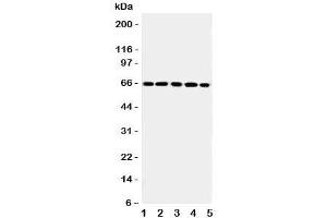 Western blot testing of RGS14 antibody and Lane 1:  rat thymus;  2: (r) spleen;  3: human Raji;  4: (h) CEM;  5: (h) Jurkat cell lysate. (RGS14 抗体  (C-Term))