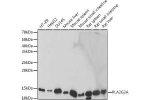 Western blot analysis of extracts of various cell lines, using PLG2A antibody (ABIN7269334) at 1:1000 dilution. (PLA2G2A 抗体)
