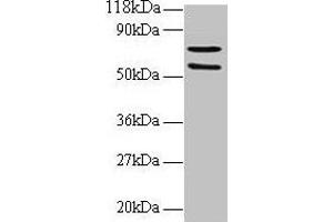 Western blot All lanes: SDHA antibody at 2 μg/mL + 293T whole cell lysate Secondary Goat polyclonal to rabbit IgG at 1/15000 dilution Predicted band size: 73, 68, 57 kDa Observed band size: 73, 57 kDa (SDHA 抗体  (AA 44-293))