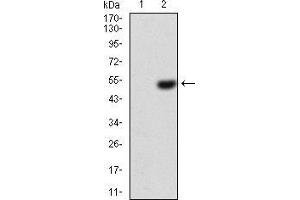 Western blot analysis using EZR mAb against HEK293 (1) and EZR (AA: 292-464)-hIgGFc transfected HEK293 (2) cell lysate. (Ezrin 抗体  (AA 292-464))