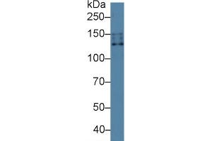 Rabbit Capture antibody from the kit in WB with Positive Control: Human 293T cell lysate.