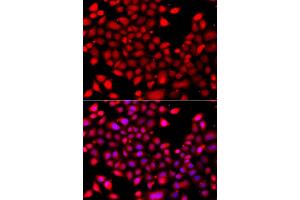 Immunofluorescence analysis of A549 cells using RARG antibody (ABIN5975541). (Retinoic Acid Receptor gamma 抗体)