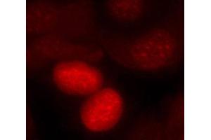 Immunofluorescence staining of methanol-fixed MCF7 cells, using phospho-FOXO1-S256 antibody.