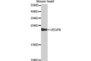 Western blot analysis of extracts of mouse heart cell lines, using VEGFB antibody. (VEGFB 抗体)