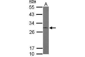 Western Blotting (WB) image for anti-Endoplasmic Reticulum Protein 29 (ERP29) antibody (ABIN2855330)