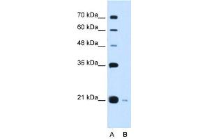 XTP3TPA antibody used at 0. (DCTPP1 抗体  (Middle Region))