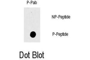 Dot blot analysis of RAF1 (phospho T269) polyclonal antibody  on nitrocellulose membrane.