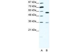 GDI1 antibody (20R-1348) used at 0.