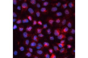 IF analysis of TFRC using anti-TFRC antibody (ABIN3043538). (Transferrin Receptor 抗体  (AA 1-198))