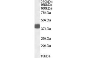 Image no. 1 for anti-F-Box Protein 32 (FBXO32) (AA 70-82) antibody (ABIN490499) (FBXO32 抗体  (AA 70-82))