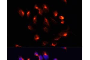 Immunofluorescence analysis of U2OS cells using CYP3A4 Polyclonal Antibody at dilution of 1:100. (CYP3A4 抗体)