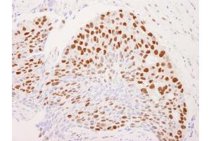 anti-REST Corepressor 1 (RCOR1) (C-Term) antibody