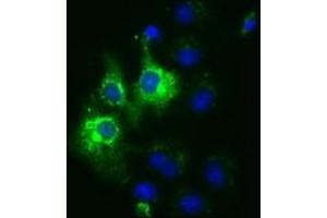 Anti-CYB5R3 mouse monoclonal antibody (ABIN2452925) immunofluorescent staining of COS7 cells transiently transfected by pCMV6-ENTRY CYB5R3 (RC201592). (CYB5R3 抗体)