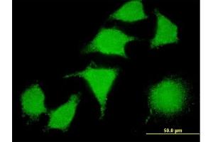 Immunofluorescence of monoclonal antibody to LIMK2 on HeLa cell. (LIMK2 抗体  (AA 1-686))