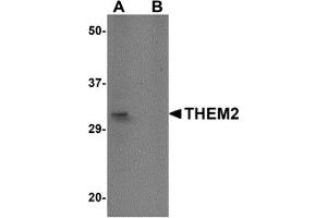 Western Blotting (WB) image for anti-Acyl-CoA Thioesterase 13 (ACOT13) (C-Term) antibody (ABIN1030735) (THEM2 抗体  (C-Term))