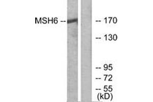 Western blot analysis of extracts from HuvEc cells, using MSH6 Antibody. (MSH6 抗体  (AA 341-390))