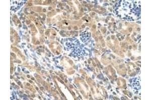 Image no. 1 for anti-Indian Hedgehog (IHH) (AA 24-73) antibody (ABIN205075) (Indian Hedgehog 抗体  (AA 24-73))