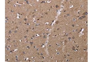 The image on the left is immunohistochemistry of paraffin-embedded Human brain tissue using ABIN7128954(CLDN23 Antibody) at dilution 1/30, on the right is treated with fusion protein. (Claudin 23 抗体)