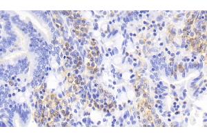 Detection of IL17 in Rabbit Small intestine Tissue using Monoclonal Antibody to Interleukin 17 (IL17) (IL-17 抗体  (AA 21-153))