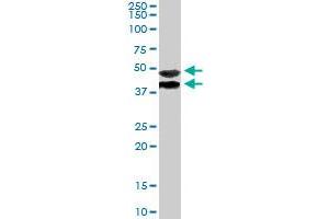 TRIM54 polyclonal antibody  staining (1ug/ml) of human muscle lysate (RIPA buffer, 35ug total protein per lane) . (TRIM54 抗体)