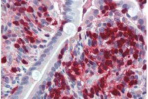 Human Small Intestine (formalin-fixed, paraffin-embedded) stained with S100A4 antibody ABIN337109 at 2. (s100a4 抗体  (AA 86-98))