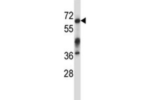 Irak3 antibody western blot analysis in mouse kidney tissue lysate. (IRAK3 抗体  (AA 517-544))