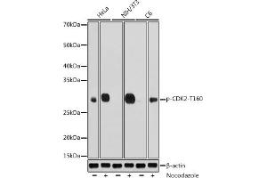 Western blot analysis of extracts of various cell lines, using Phospho-CDK2-T160 antibody (ABIN3020138, ABIN3020139, ABIN3020140, ABIN1681460 and ABIN1681461) at 1:1000 dilution. (CDK2 抗体  (pThr160))