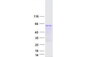Western Blotting (WB) image for T-Complex 11, Testis-Specific (TCP11) (Transcript Variant 1) protein (Myc-DYKDDDDK Tag) (ABIN2733371)
