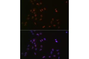 Immunofluorescence analysis of C6 cells using L Rabbit mAb (ABIN7270266) at dilution of 1:100 (40x lens). (ASH2L 抗体)
