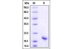 SDS-PAGE (SDS) image for Tumor Necrosis Factor alpha (TNF alpha) (AA 77-233) (Active) protein (His tag,AVI tag,Biotin) (ABIN2870564)