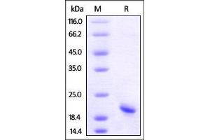 Biotinylated Human TNF-alpha (HPLC-verified) on SDS-PAGE under reducing (R) condition.