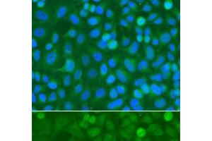 Immunofluorescence analysis of A549 cells using NCK1 Polyclonal Antibody (NCK1 抗体)