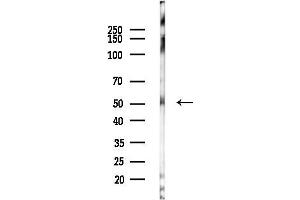 anti-Retinoic Acid Receptor, alpha (RARA) (N-Term) antibody