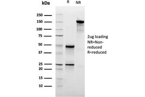 SDS-PAGE Analysis Purified CD47 Mouse Monoclonal Antibody (IAP/3019). (CD47 抗体  (AA 18-135))